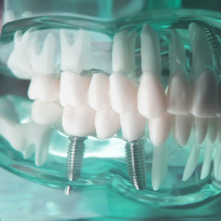 Действия при ненадлежащем качестве лечения в стоматологической клинике.